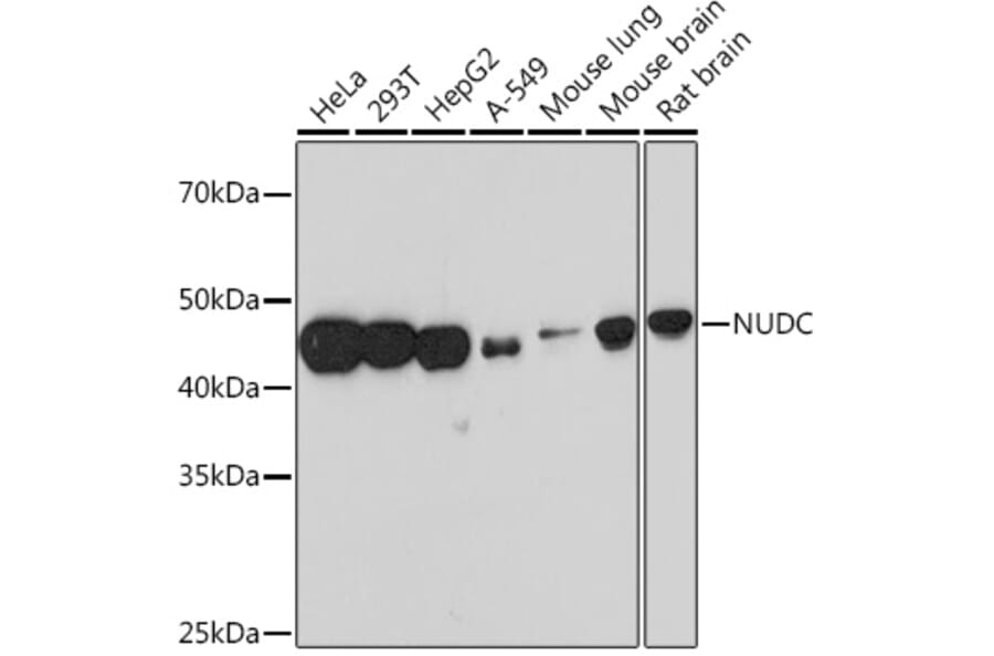 Western Blot - Anti-NUDC Antibody [ARC1103] (A308841) - Antibodies.com