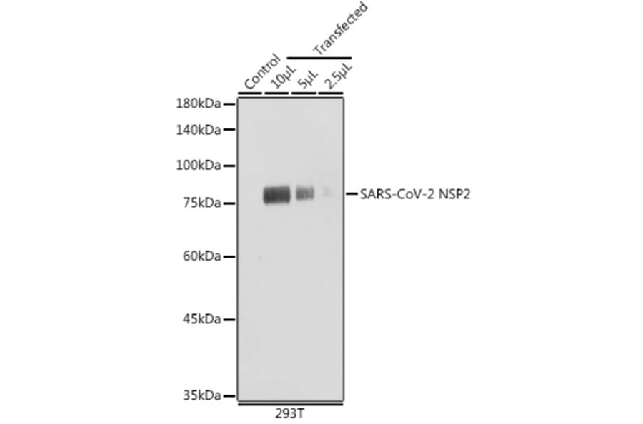 Western Blot - Anti-SARS-CoV2 NSP2 Antibody (A308842) - Antibodies.com