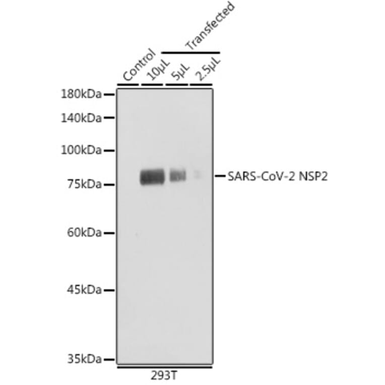 Western Blot - Anti-SARS-CoV2 NSP2 Antibody (A308842) - Antibodies.com