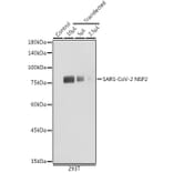 Western Blot - Anti-SARS-CoV2 NSP2 Antibody (A308842) - Antibodies.com