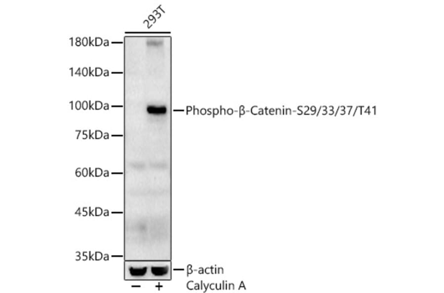 Western Blot - Anti-beta Catenin (phospho Ser29 + Ser33 + Ser37 + Thr41) Antibody (A308843) - Antibodies.com