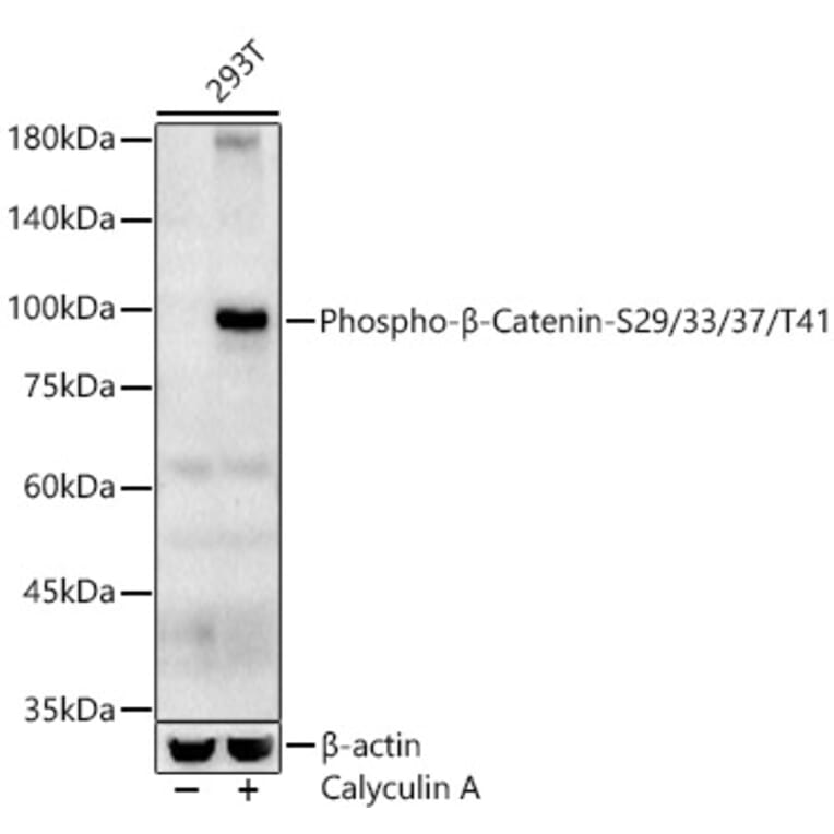 Western Blot - Anti-beta Catenin (phospho Ser29 + Ser33 + Ser37 + Thr41) Antibody (A308843) - Antibodies.com