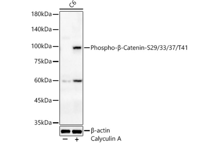 Western Blot - Anti-beta Catenin (phospho Ser29 + Ser33 + Ser37 + Thr41) Antibody (A308843) - Antibodies.com