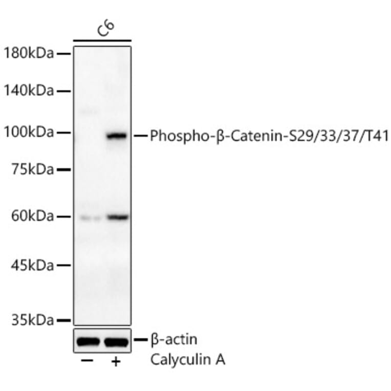Western Blot - Anti-beta Catenin (phospho Ser29 + Ser33 + Ser37 + Thr41) Antibody (A308843) - Antibodies.com