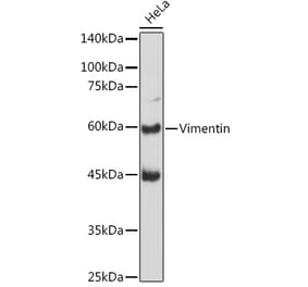 Western Blot - Anti-Vimentin Antibody (A308844) - Antibodies.com