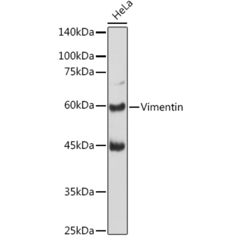 Western Blot - Anti-Vimentin Antibody (A308844) - Antibodies.com