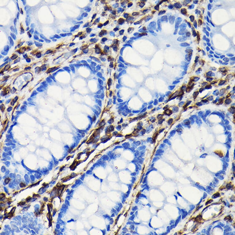 Immunohistochemistry - Anti-Vimentin Antibody (A308844) - Antibodies.com