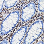 Immunohistochemistry - Anti-Vimentin Antibody (A308844) - Antibodies.com