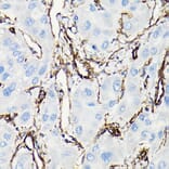 Immunohistochemistry - Anti-Vimentin Antibody (A308844) - Antibodies.com