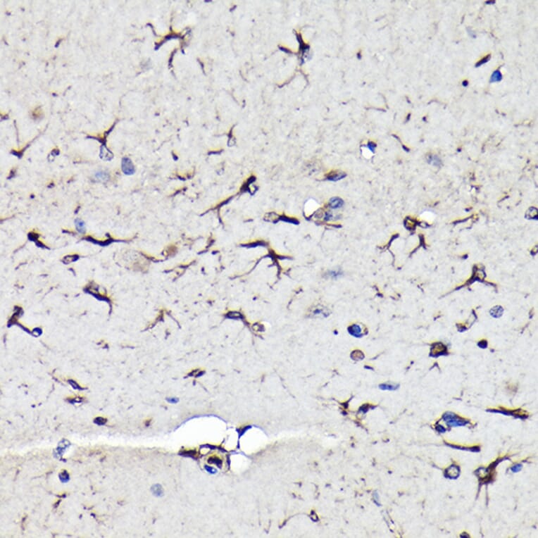 Immunohistochemistry - Anti-Vimentin Antibody (A308844) - Antibodies.com