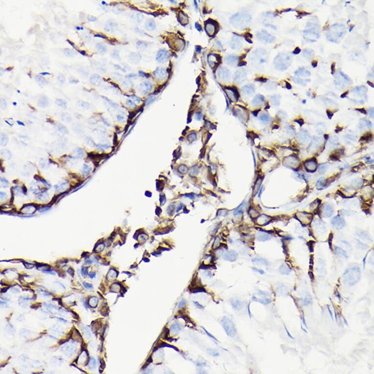 Immunohistochemistry - Anti-Vimentin Antibody (A308844) - Antibodies.com