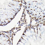 Immunohistochemistry - Anti-Vimentin Antibody (A308844) - Antibodies.com