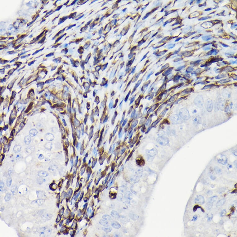 Immunohistochemistry - Anti-Vimentin Antibody (A308844) - Antibodies.com