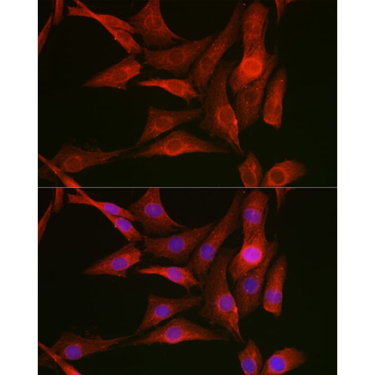 Immunofluorescence - Anti-Vimentin Antibody (A308844) - Antibodies.com