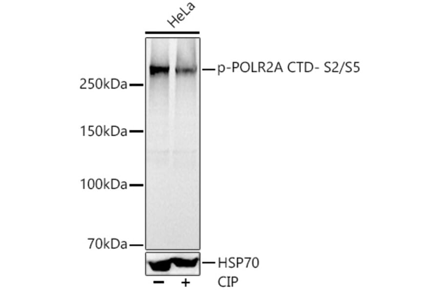 Western Blot - Anti-RNA polymerase II CTD repeat YSPTSPS (phospho Ser2 + Ser5) Antibody (A308845) - Antibodies.com