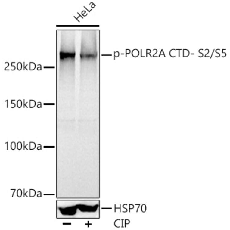 Western Blot - Anti-RNA polymerase II CTD repeat YSPTSPS (phospho Ser2 + Ser5) Antibody (A308845) - Antibodies.com
