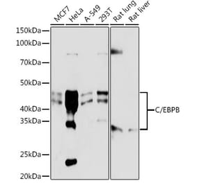 Western Blot - Anti-CEBP Beta Antibody [ARC0017] (A308846) - Antibodies.com