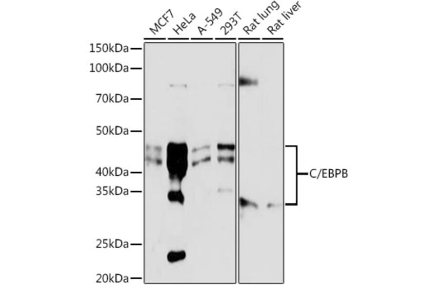 Western Blot - Anti-CEBP Beta Antibody [ARC0017] (A308846) - Antibodies.com