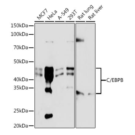 Western Blot - Anti-CEBP Beta Antibody [ARC0017] (A308846) - Antibodies.com
