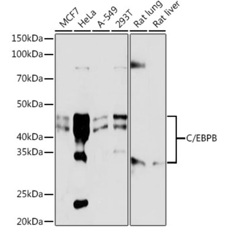 Western Blot - Anti-CEBP Beta Antibody [ARC0017] (A308846) - Antibodies.com