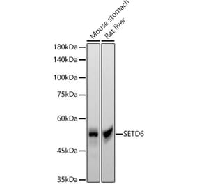 Western Blot - Anti-SETD6 Antibody [ARC55206] (A308847) - Antibodies.com