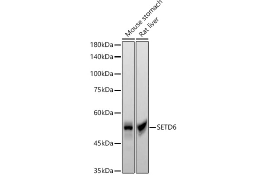 Western Blot - Anti-SETD6 Antibody [ARC55206] (A308847) - Antibodies.com