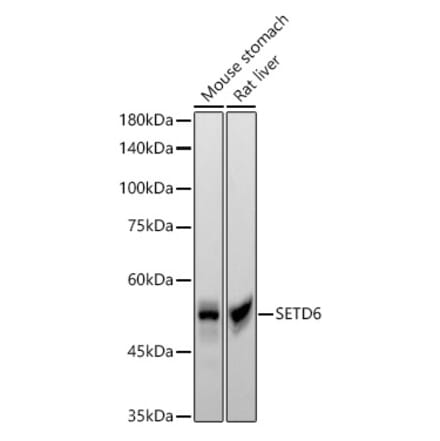 Western Blot - Anti-SETD6 Antibody [ARC55206] (A308847) - Antibodies.com