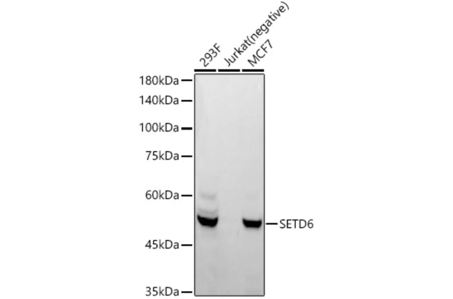 Western Blot - Anti-SETD6 Antibody [ARC55206] (A308847) - Antibodies.com