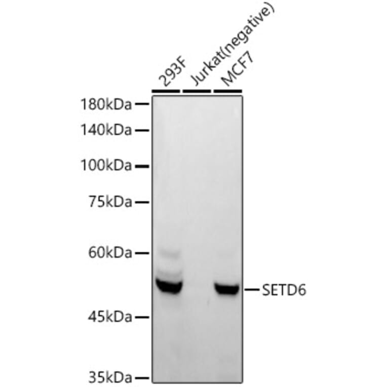 Western Blot - Anti-SETD6 Antibody [ARC55206] (A308847) - Antibodies.com