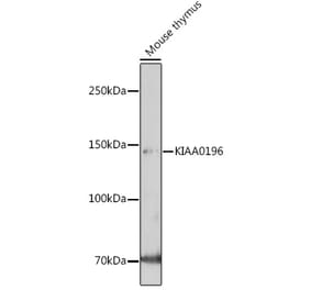 Western Blot - Anti-Strumpellin Antibody (A308848) - Antibodies.com