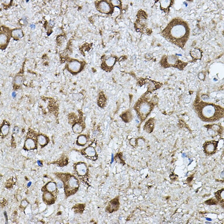 Immunohistochemistry - Anti-Strumpellin Antibody (A308848) - Antibodies.com