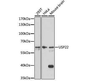 Western Blot - Anti-USP22 Antibody (A308849) - Antibodies.com
