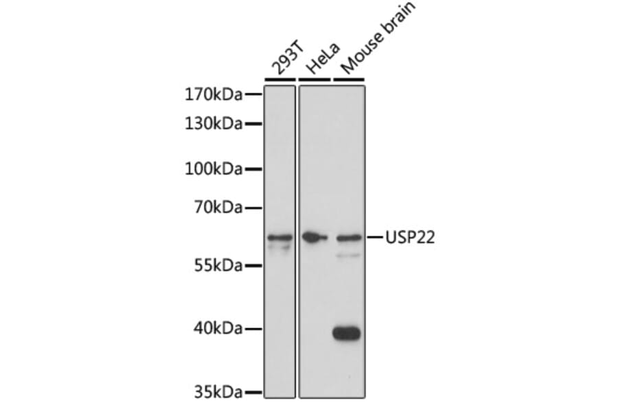 Western Blot - Anti-USP22 Antibody (A308849) - Antibodies.com