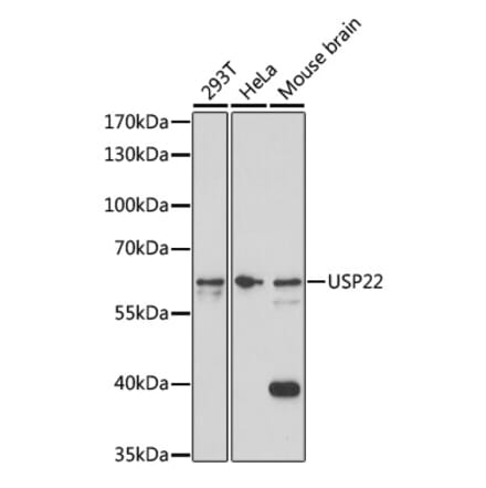 Western Blot - Anti-USP22 Antibody (A308849) - Antibodies.com