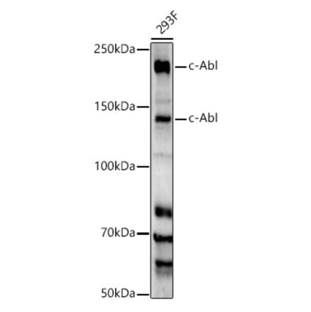 Western Blot - Anti-ABL1 Antibody [ARC55104] (A308850) - Antibodies.com