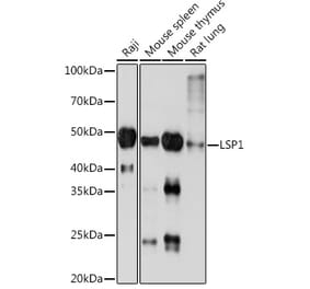 Western Blot - Anti-LSP1 Antibody [ARC1952] (A308852) - Antibodies.com