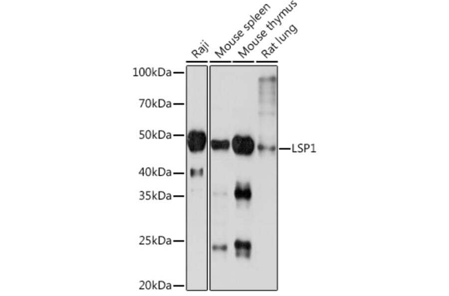 Western Blot - Anti-LSP1 Antibody [ARC1952] (A308852) - Antibodies.com
