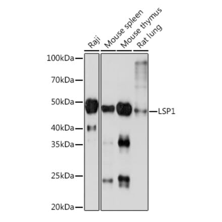 Western Blot - Anti-LSP1 Antibody [ARC1952] (A308852) - Antibodies.com