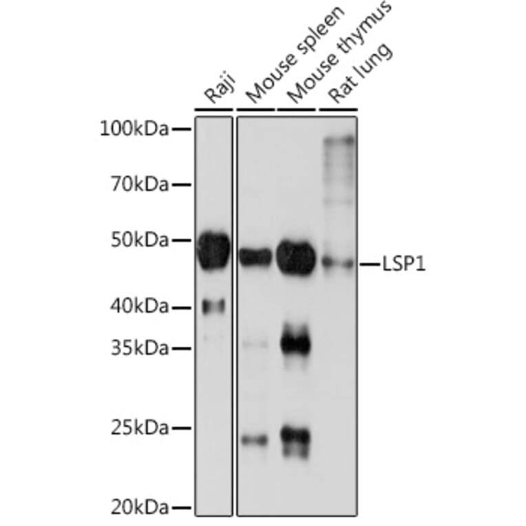 Western Blot - Anti-LSP1 Antibody [ARC1952] (A308852) - Antibodies.com