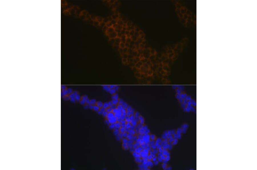 Immunofluorescence - Anti-LSP1 Antibody [ARC1952] (A308852) - Antibodies.com