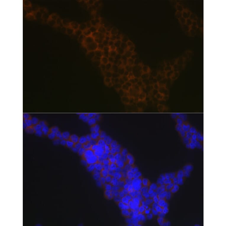 Immunofluorescence - Anti-LSP1 Antibody [ARC1952] (A308852) - Antibodies.com
