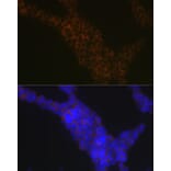Immunofluorescence - Anti-LSP1 Antibody [ARC1952] (A308852) - Antibodies.com