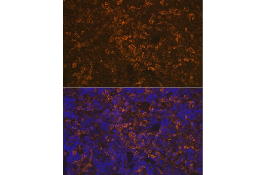 Immunofluorescence - Anti-LSP1 Antibody [ARC1952] (A308852) - Antibodies.com
