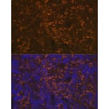 Immunofluorescence - Anti-LSP1 Antibody [ARC1952] (A308852) - Antibodies.com