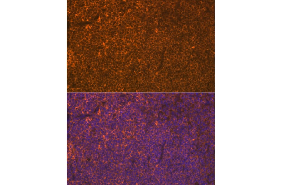 Immunofluorescence - Anti-LSP1 Antibody [ARC1952] (A308852) - Antibodies.com