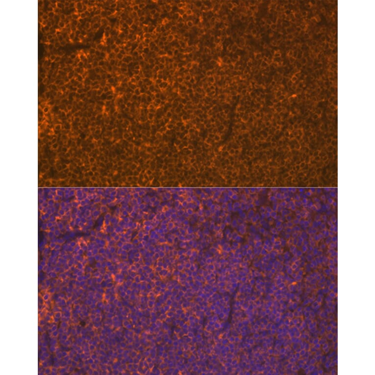 Immunofluorescence - Anti-LSP1 Antibody [ARC1952] (A308852) - Antibodies.com