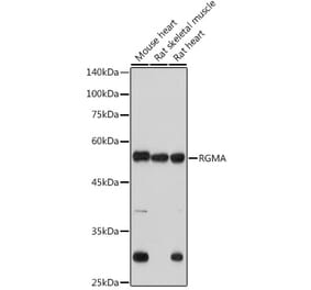 Western Blot - Anti-Repulsive Guidance Molecule A Antibody [ARC2546] (A308854) - Antibodies.com