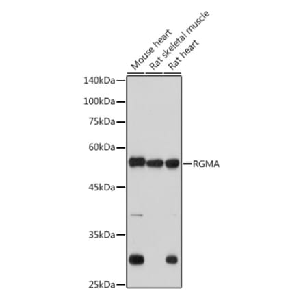 Western Blot - Anti-Repulsive Guidance Molecule A Antibody [ARC2546] (A308854) - Antibodies.com