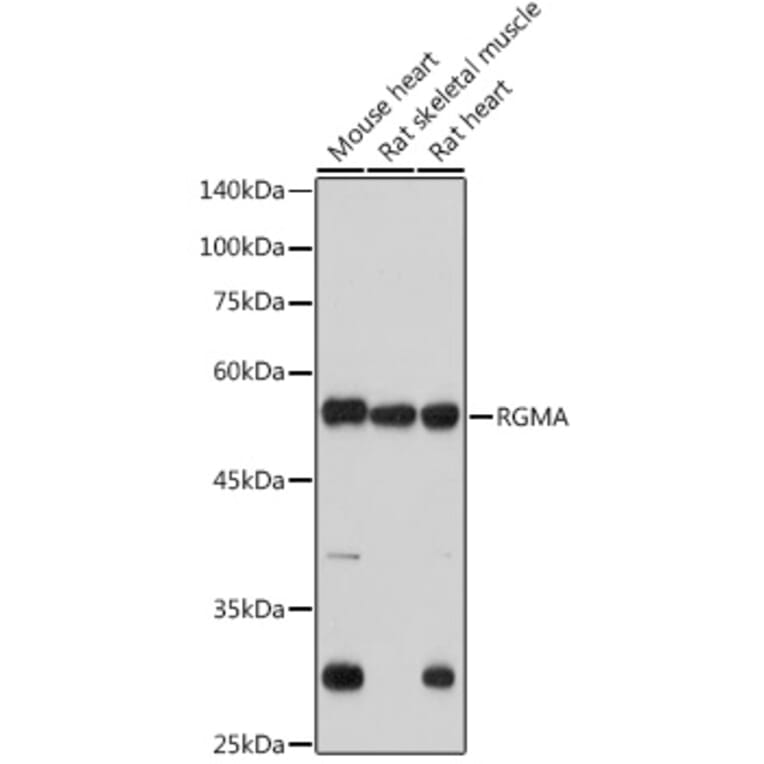 Western Blot - Anti-Repulsive Guidance Molecule A Antibody [ARC2546] (A308854) - Antibodies.com