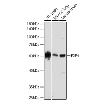 Western Blot - Anti-E2F4 Antibody [ARC2223] (A308859) - Antibodies.com